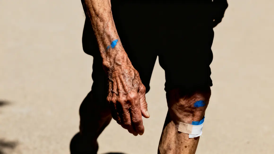 bleus bras jambes personnes agees